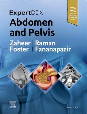Zaheer / Raman / Foster |  Expertddx: Abdomen and Pelvis | Buch |  Sack Fachmedien