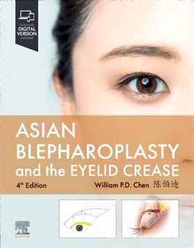 Chen |  Asian Blepharoplasty and the Eyelid Crease | Buch |  Sack Fachmedien
