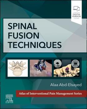 Abd-Elsayed |  Spinal Fusion Techniques | Buch |  Sack Fachmedien