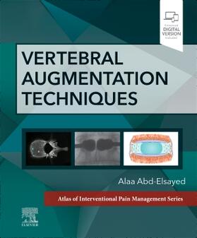 Abd-Elsayed |  Vertebral Augmentation Techniques | Buch |  Sack Fachmedien