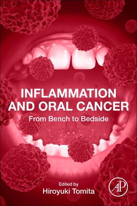 Tomita |  Inflammation and Oral Cancer | Buch |  Sack Fachmedien