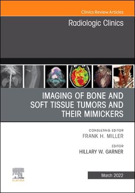 Garner |  Imaging of Bone and Soft Tissue Tumors and Their Mimickers, an Issue of Radiologic Clinics of North America | Buch |  Sack Fachmedien