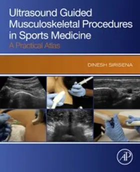 Sirisena |  Ultrasound Guided Musculoskeletal Procedures in Sports Medicine | eBook | Sack Fachmedien