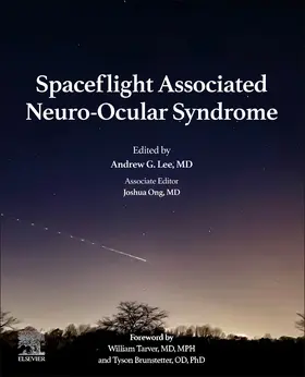 Lee / Ong |  Spaceflight Associated Neuro-Ocular Syndrome | Buch |  Sack Fachmedien