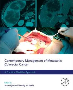 Ejaz |  Contemporary Management of Metastatic Colorectal Cancer | Buch |  Sack Fachmedien