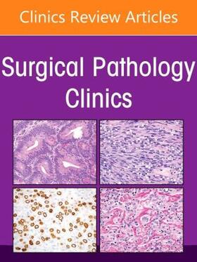 Zhou |  Genitourinary Pathology, an Issue of Surgical Pathology Clinics | Buch |  Sack Fachmedien