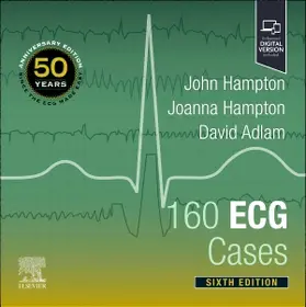 Hampton / Adlam |  160 ECG Cases | Buch |  Sack Fachmedien