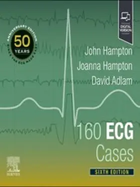 Hampton / Adlam |  160 ECG Cases | eBook | Sack Fachmedien