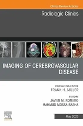 Romero MD / Mossa-Basha MD / Mossa-Basha |  Imaging of Cerebrovascular Disease, An Issue of Radiologic Clinics of North America, E-Book | eBook | Sack Fachmedien