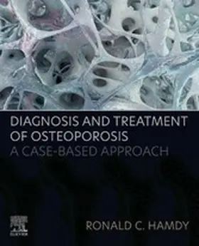 Hamdy |  Diagnosis and Treatment of Osteoporosis | eBook | Sack Fachmedien