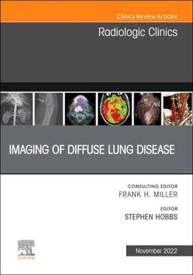 Hobbs |  Imaging of Diffuse Lung Disease, an Issue of Radiologic Clinics of North America | Buch |  Sack Fachmedien