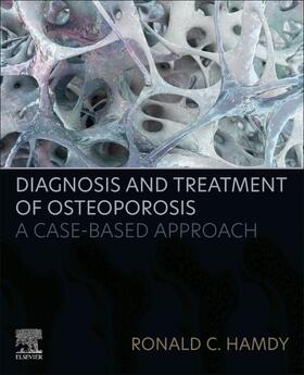 Hamdy |  Diagnosis and Treatment of Osteoporosis | Buch |  Sack Fachmedien