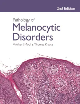 Mooi / Krausz |  Pathology of Melanocytic Disorders 2ed | Buch |  Sack Fachmedien