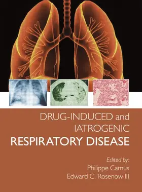 Camus / Rosenow III |  Drug-induced and Iatrogenic Respiratory Disease | Buch |  Sack Fachmedien