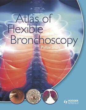 Shah |  Atlas of Flexible Bronchoscopy | Buch |  Sack Fachmedien