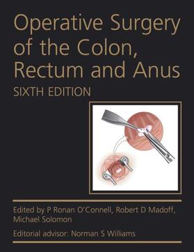 O'Connell / Madoff / Solomon |  Operative Surgery of the Colon, Rectum and Anus | Buch |  Sack Fachmedien