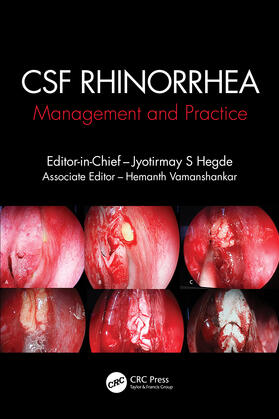 Vamanshankar / Hegde |  CSF Rhinorrhoea | Buch |  Sack Fachmedien