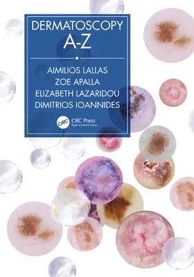 Lallas / Apalla / Lazaridou |  Dermatoscopy A-Z | Buch |  Sack Fachmedien