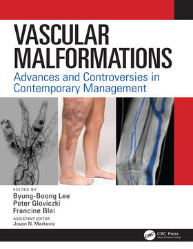 Lee / Gloviczki / Blei |  Vascular Malformations | Buch |  Sack Fachmedien