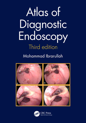 Ibrarullah |  Atlas of Diagnostic Endoscopy, 3e | Buch |  Sack Fachmedien