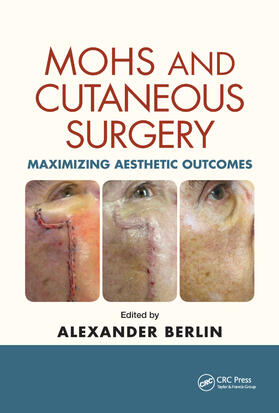 Berlin |  Mohs and Cutaneous Surgery | Buch |  Sack Fachmedien