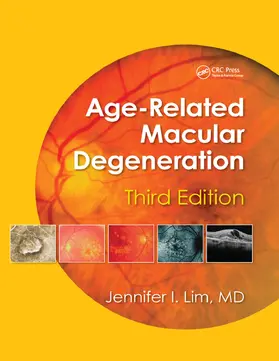 Lim |  Age-Related Macular Degeneration, Third Edition | Buch |  Sack Fachmedien