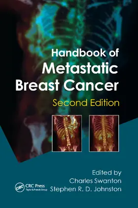 Swanton / Johnston |  Handbook of Metastatic Breast Cancer | Buch |  Sack Fachmedien