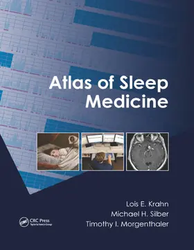 Krahn / Silber / Morgenthaler |  Atlas of Sleep Medicine | Buch |  Sack Fachmedien