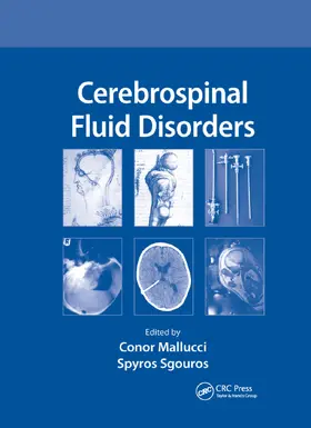 Mallucci / Sgouros |  Cerebrospinal Fluid Disorders | Buch |  Sack Fachmedien