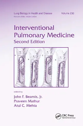 Beamis / Mathur / Mehta |  Interventional Pulmonary Medicine | Buch |  Sack Fachmedien