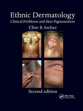 Archer |  Ethnic Dermatology | Buch |  Sack Fachmedien