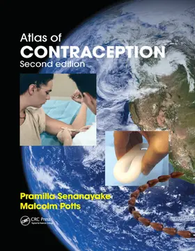 Senanayake / Potts |  Atlas of Contraception | Buch |  Sack Fachmedien