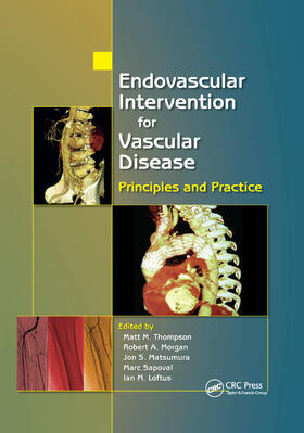 Thompson / Morgan / Matsumura |  Endovascular Intervention for Vascular Disease | Buch |  Sack Fachmedien