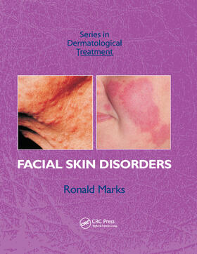 Marks |  Facial Skin Disorders | Buch |  Sack Fachmedien