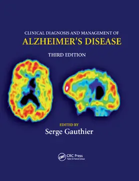 Gauthier |  Clinical Diagnosis and Management of Alzheimer's Disease | Buch |  Sack Fachmedien