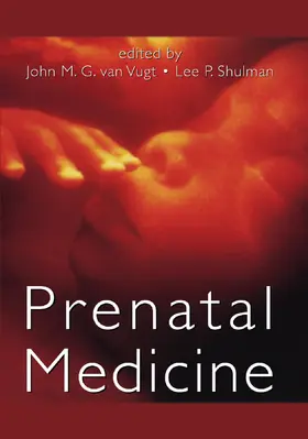 van Vugt / Shulman |  Prenatal Medicine | Buch |  Sack Fachmedien