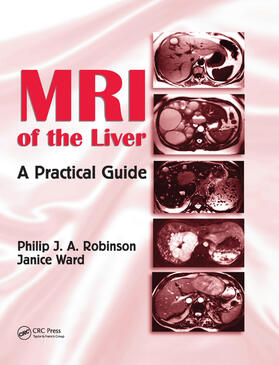 Robinson / Ward |  MRI of the Liver | Buch |  Sack Fachmedien