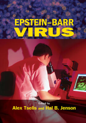 Tselis / Jenson |  Epstein-Barr Virus | Buch |  Sack Fachmedien