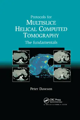 Peter |  Protocols for Multislice Helical Computed Tomography | Buch |  Sack Fachmedien