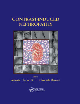 Bartorelli / Marenzi |  Contrast-Induced Nephropathy in Interventional Cardiovascular Medicine | Buch |  Sack Fachmedien