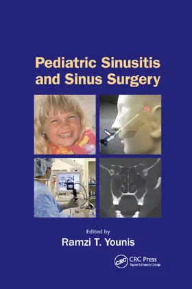 Younis |  Pediatric Sinusitis and Sinus Surgery | Buch |  Sack Fachmedien