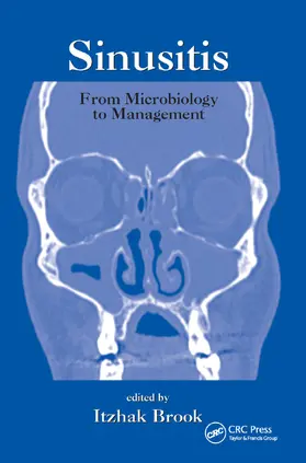 Brook |  Sinusitis | Buch |  Sack Fachmedien