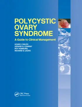 Balen / Conway / Homburg |  Polycystic Ovary Syndrome | Buch |  Sack Fachmedien