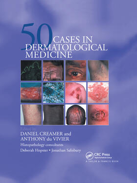 Creamer / du Vivier |  Fifty Dermatological Cases | Buch |  Sack Fachmedien