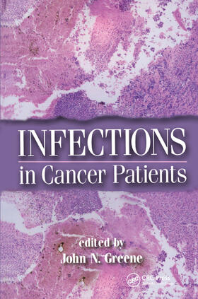 Greene |  Infections in Cancer Patients | Buch |  Sack Fachmedien