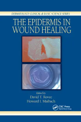 Rovee / Maibach |  The Epidermis in Wound Healing | Buch |  Sack Fachmedien