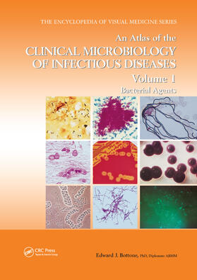 Bottone |  An Atlas of the Clinical Microbiology of Infectious Diseases, Volume 1 | Buch |  Sack Fachmedien