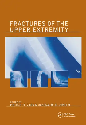 Ziran |  Fractures of the Upper Extremity | Buch |  Sack Fachmedien