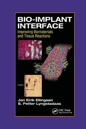 Ellingsen / Lyngstadaas |  Bio-Implant Interface | Buch |  Sack Fachmedien