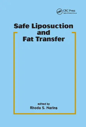 Narins |  Safe Liposuction and Fat Transfer | Buch |  Sack Fachmedien